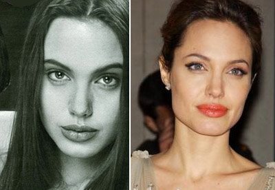 http://2.bp.blogspot.com/_bQ0SqifjNcg/Sn5u6wrC24I/AAAAAAAACXQ/o0y9r2viWwg/s1600/angelina_jolie_nose_job_2.jpg