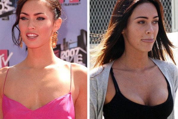 megan fox before and after surgery pictures. Megan Fox before and after