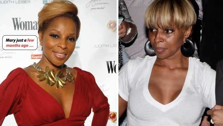 Mary J Blige before and after breast implants. 