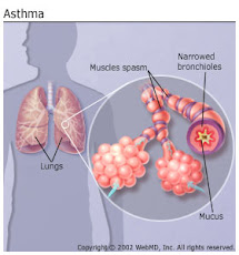 UPDATE PEDIATRIC ASTHMA