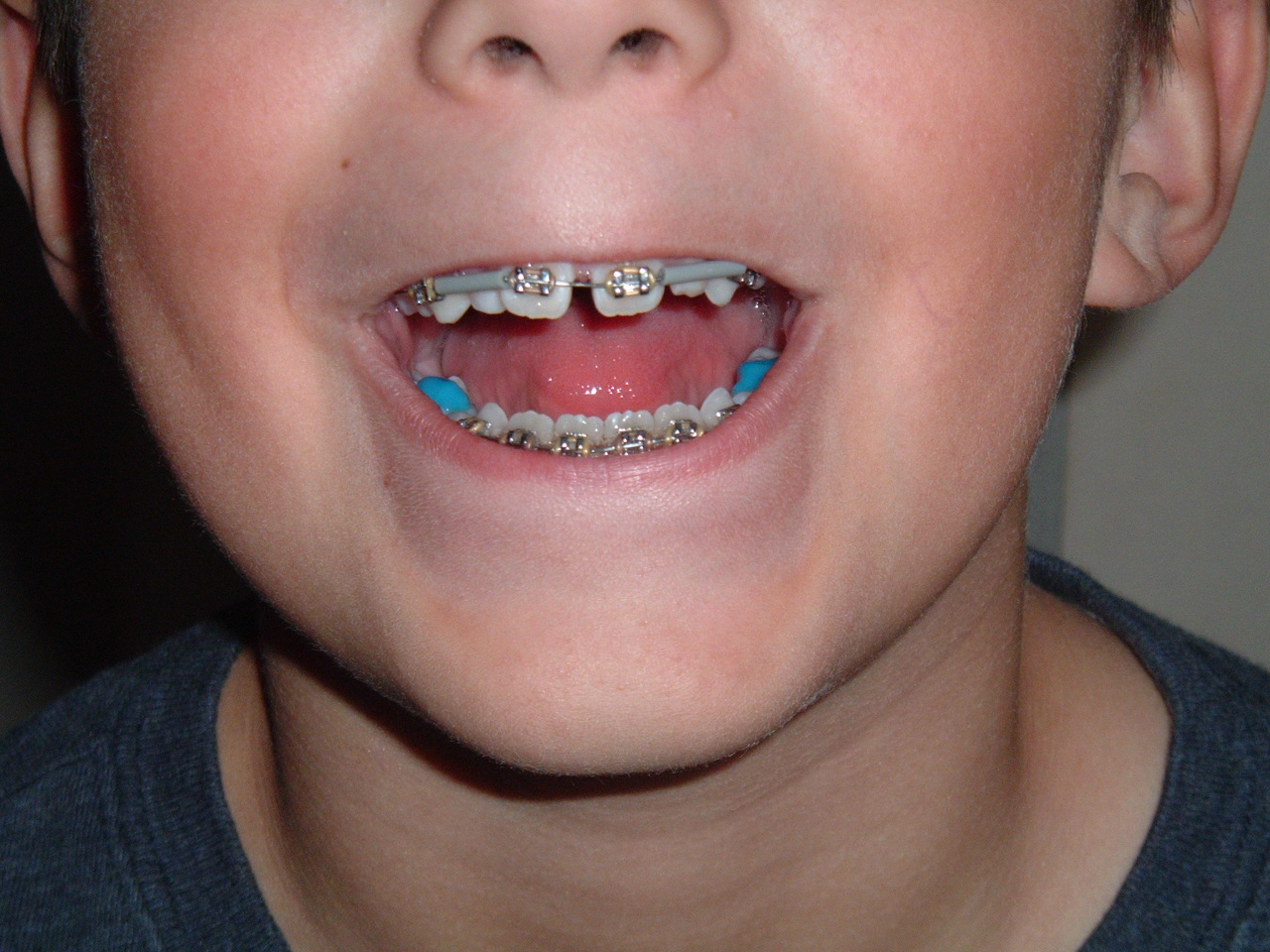 Four Blessings Academy Almost Wordless Wednesday The Prophet Got