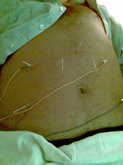 ACUPUNTURA ESTETICA