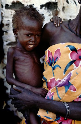 Malnutrition essay
