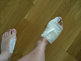 Skadad+fot - Löpningen gav mig infektion och hög feber