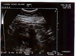 Baby 10 weeks