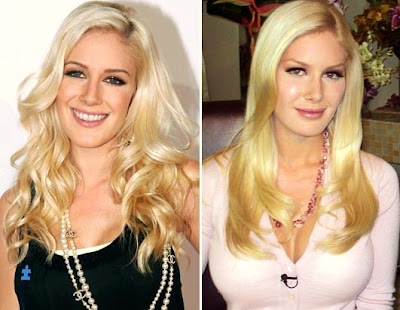 heidi montag plastic surgery before and after pictures. heidi montag surgery before