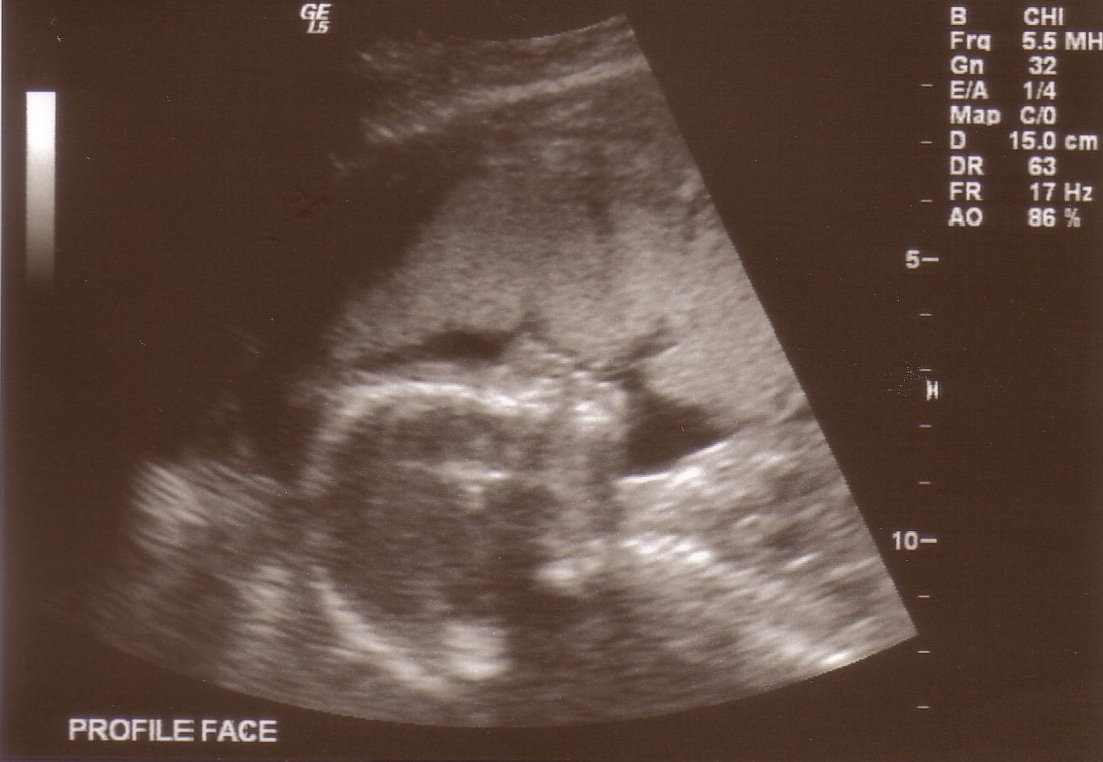 [20+weeks100.jpg]