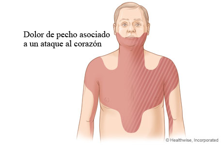 Сильный кашель болит грудная клетка