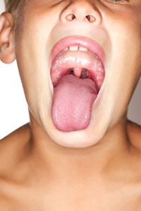 [bademcik+ameliyatı.jpg]