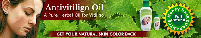 vitiligo pictures