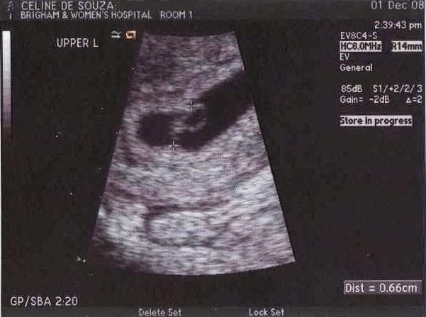 [6w4d-#2.JPG]