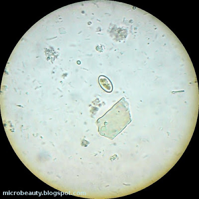 Microorganism.
