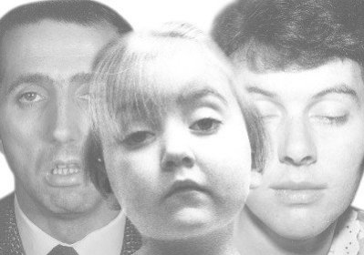 [myasthenia_gravis_faces.jpg]