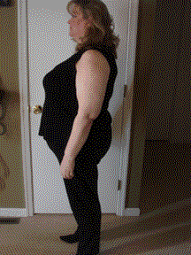 Before-Pics--side.gif