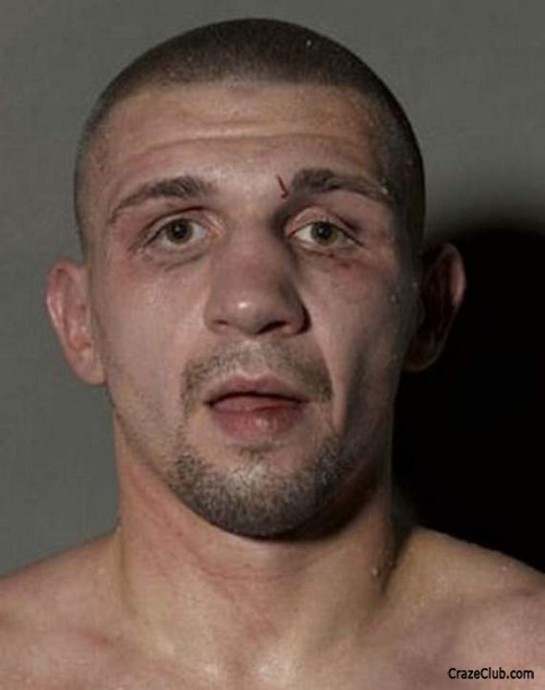 Boxers Before and After the Fight