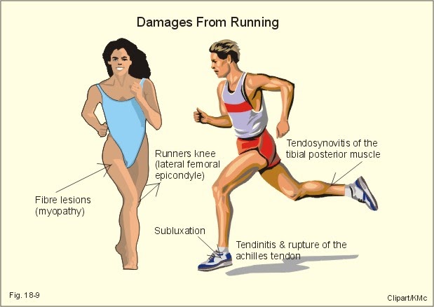 Sporty Foot: 8 Common Running Injuries cheetah diagram 