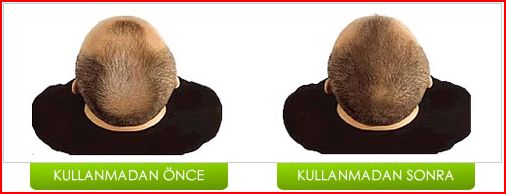 Başınıza Gelebilecek En Güzel Şey