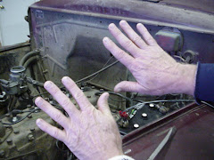 Roger's Hands Before