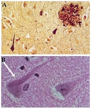 [Placas+y+Ovillos+1.jpg]