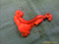 By request: the appendix.