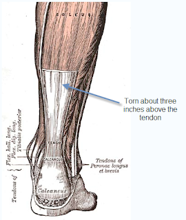 1000milesin1year: Two hours in the emergency room