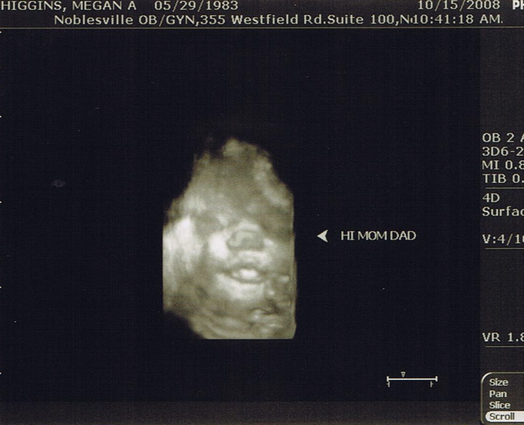 [36wk+ultrasound1.jpg]