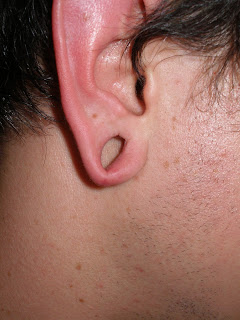 Industrial Strength Body Piercing Australia: Ear lobe stitch and Repair!