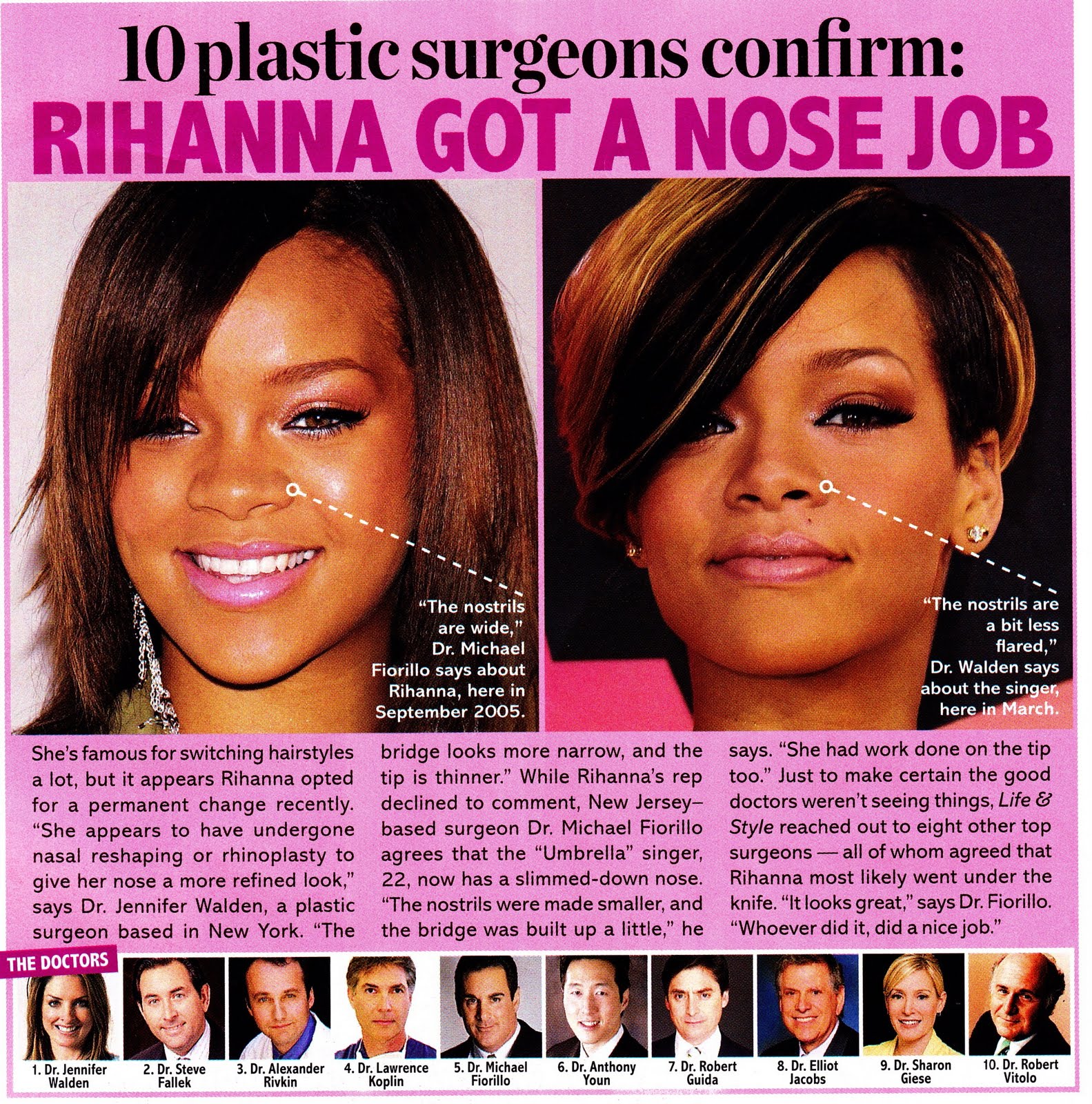 Life and Style Rihanna Rhinoplasty? plastic surgery