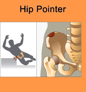 Hip_Pointer.jpg
