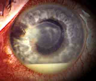 Mein Praktisches Jahr (PJ): Augenheilkunde - 13. Woche - \