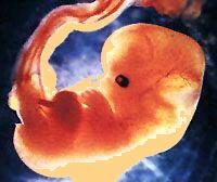 [Wk+6+human+fetus1.jpg]