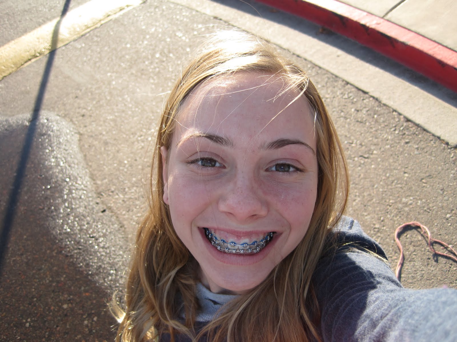 THE WEEKLY BLAHS OF MADDIE (WHO ELSE) Where Oh Where Did my Braces Go?!