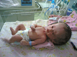 Diagnosis: Hidrosefalus (Apakah yang akan terjadi kepada bayi ini?)