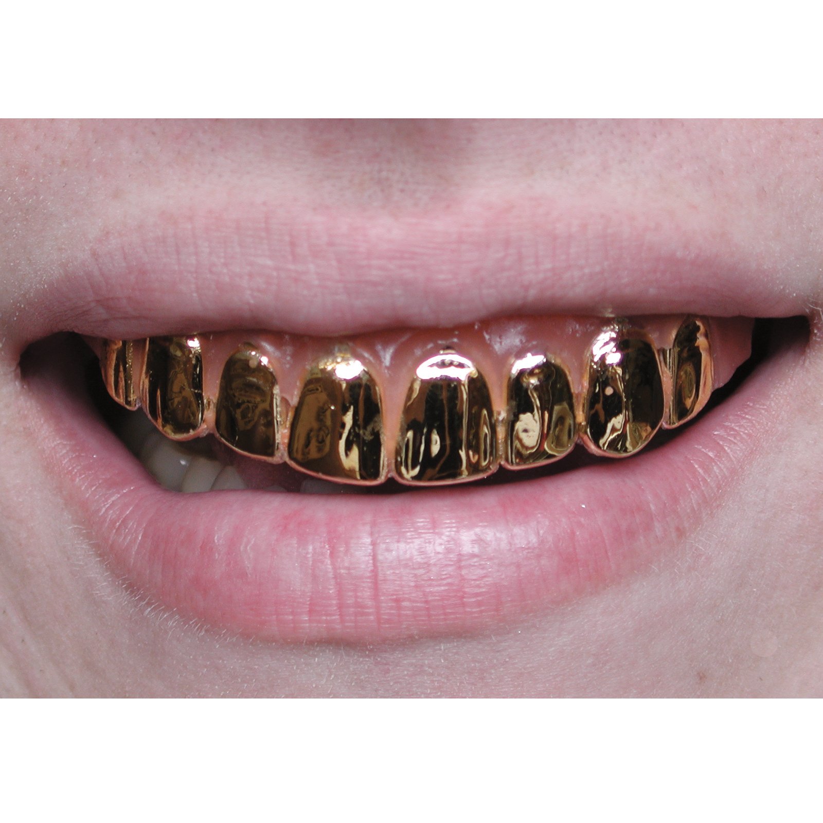 [gold+teeth.jpg]