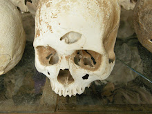Skull with bullet hole.