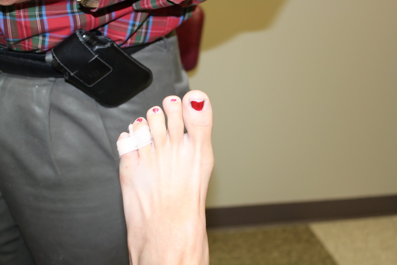 this funky junky broken pinkie toe! what can you do?