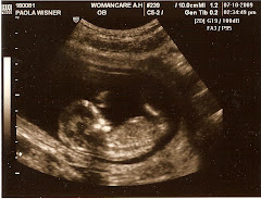 Baby at 13 weeks (hand)