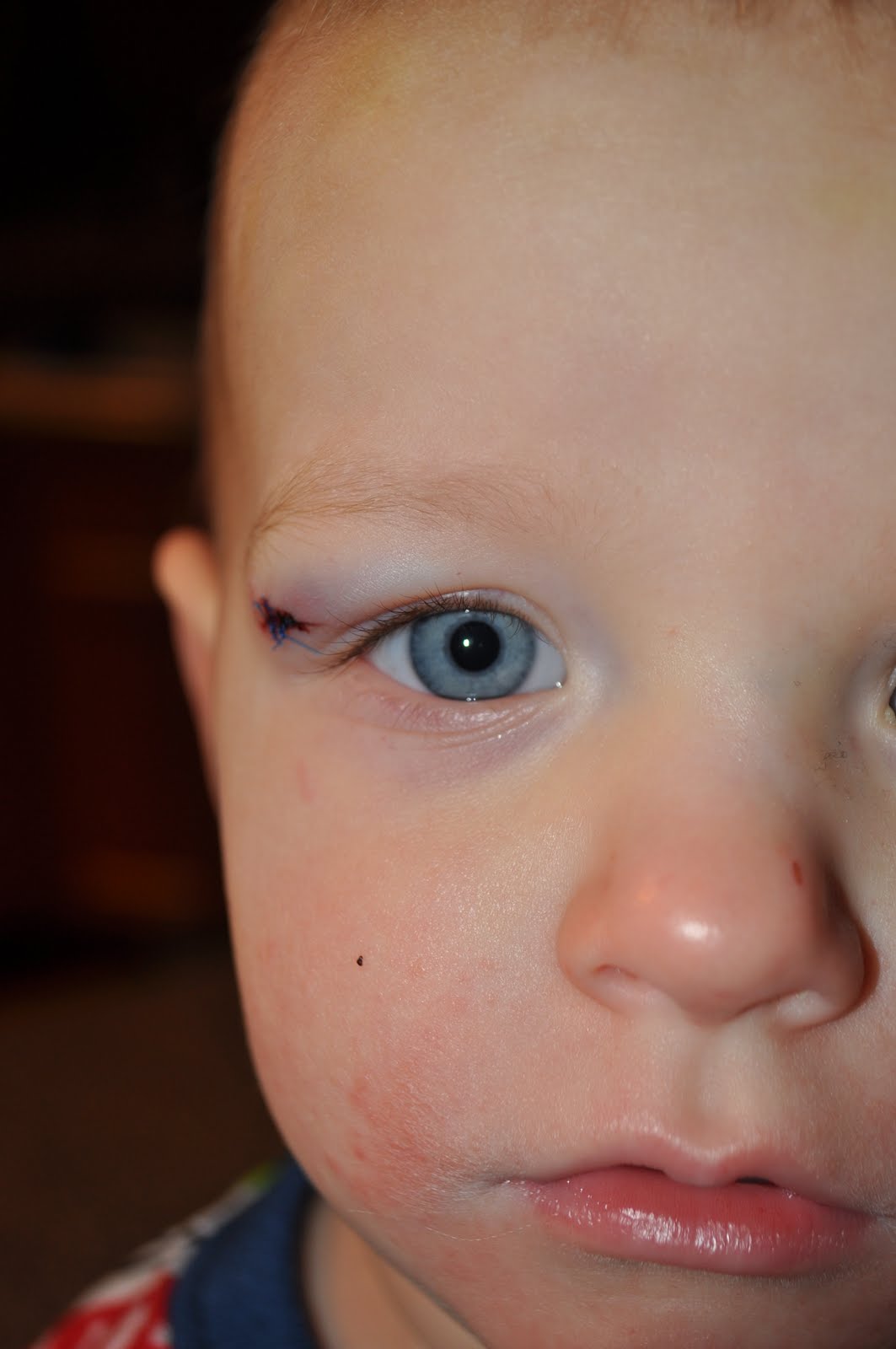 The Poulsen Family Baby hurt...