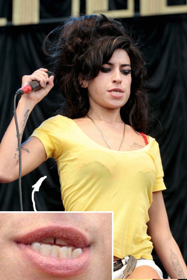 [celebrity_microscope_35.jpg]