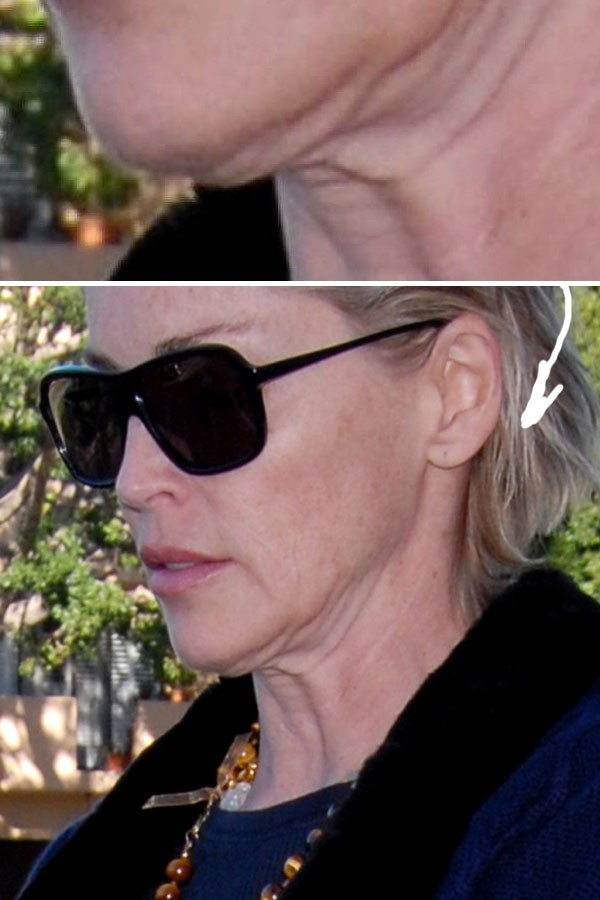 [celebrity_microscope_26.jpg]