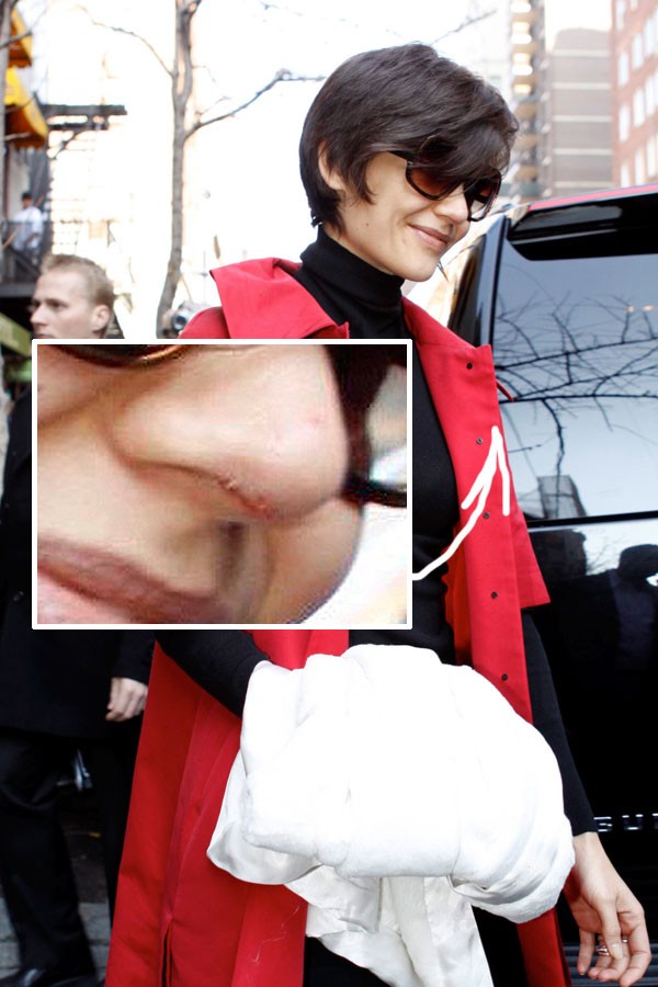 [celebrity_microscope_23.jpg]