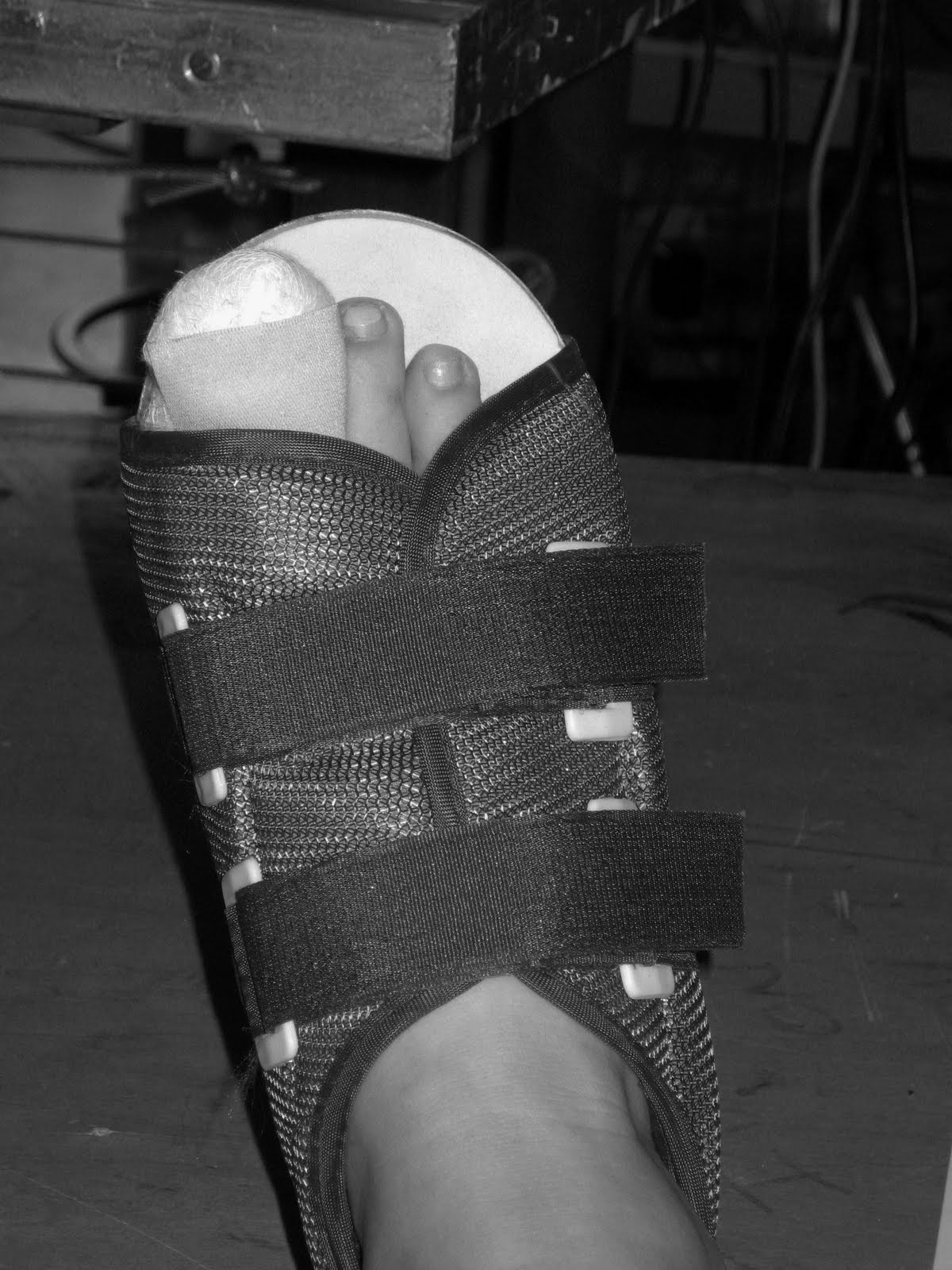 ReintroducingTouch The Broken Big Toe