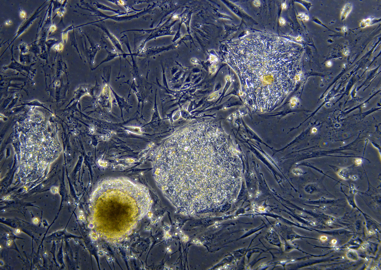 1 стволовые клетки. Эмбриональные стволовые клетки под микроскопом. Фетальная стволовая клетка. Фетальные стволовые клетки под микроскопом. Кроветворные стволовые клетки под микроскопом.