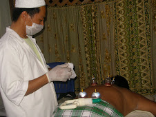 BEKAM (CUPPING THERAPY)