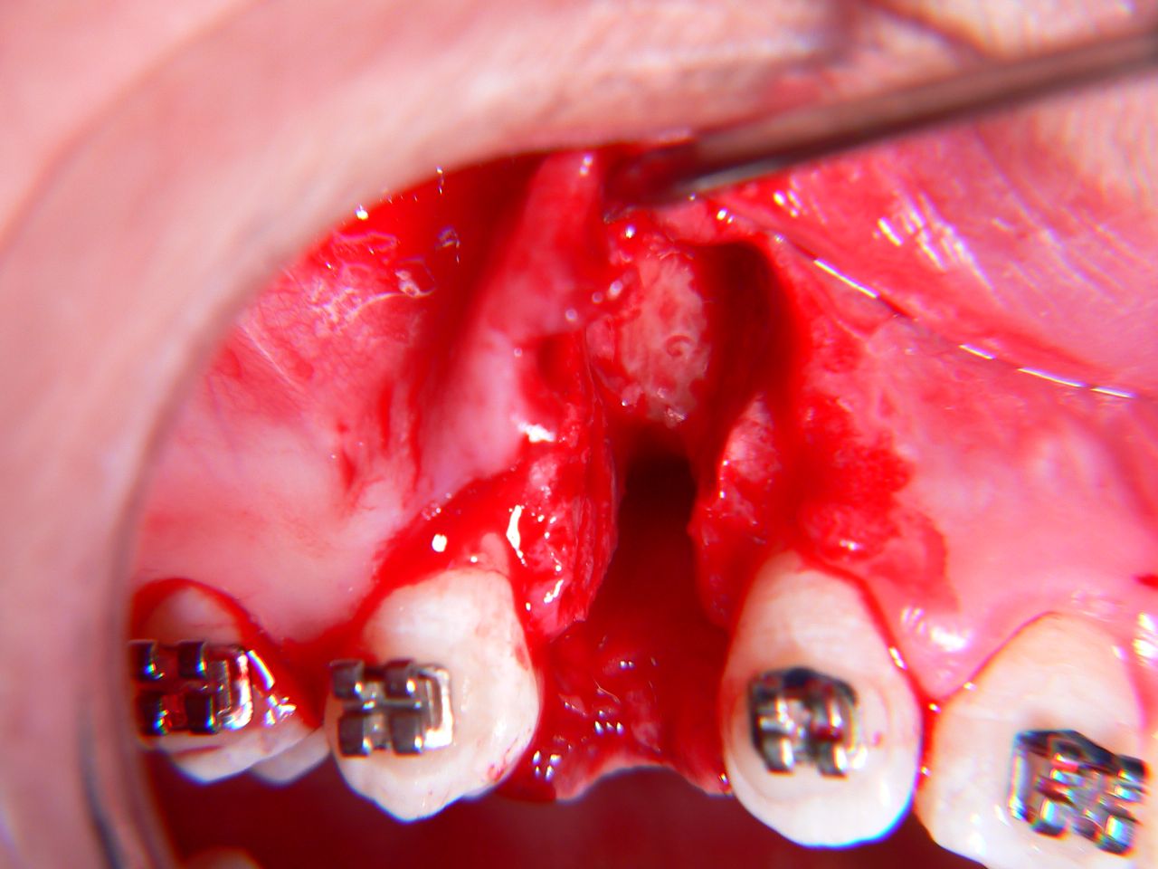 Dr Marlo Vinicios Duarte Lemos - Cirurgião Dentista - Odontologia