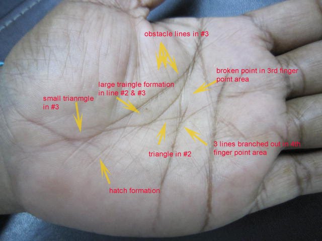 Modern & Multidimensional Iridology: Medical Palmistry Analysis