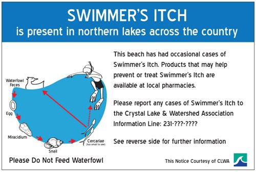 treatment for swimmers itch