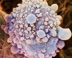 Pancreas Cencer Cell