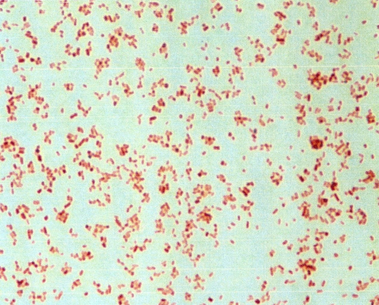 Куриный сальмонеллез. Сальмонелла тифимуриум. Сальмонелла Тифи микроскопия. Salmonella Typhimurium микроскопия. Сальмонеллы бактериоскопия.