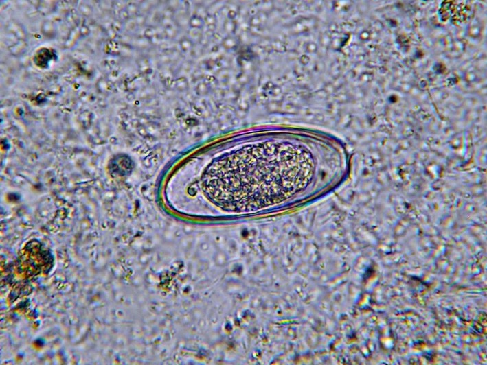Fun With Microbiology (What's Buggin' You?): Enterobius ...
Pinworm Eggs In Poop